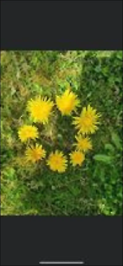 En moyenne, les tumeurs de la vessie sont...