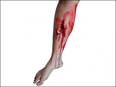 À cause des dégâts de la bombe, tu t'es ouvert la jambe et la blessure est grande ouverte. Le plafond commence à s'effondrer ! Que fais-tu ?