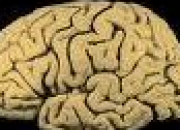 Quiz Anatomie : connaissez-vous votre cerveau ?