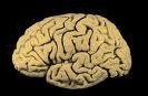 Anatomie : connaissez-vous votre cerveau ?