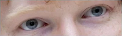 Yeux bleus, taches de rousseur. Qui ça peut-il être ?