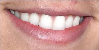 Quel beau sourire ! À qui appartient-il ?