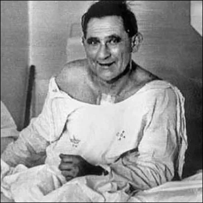 Qui est Louis Washkansky, médiatisé en 1967 ?