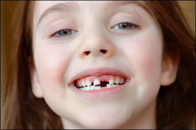 Julie n'oublie pas qu'on doit aller chez le dentiste &agrave; 10 heures pour faire un contr&ocirc;le de tes ....... !