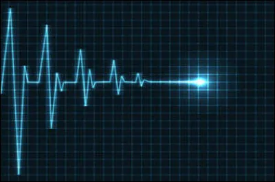 Que se passe-t-il lors dun arrêt cardiaque ?