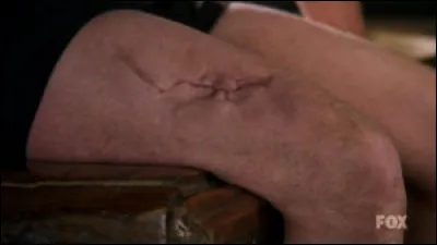 Après que House s'est injecté un médicament expérimental seulement testé sur les rats afin que son muscle repousse, qu'a-t-il eu comme effet secondaire ?