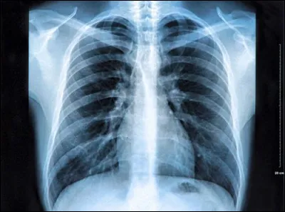 Au fil des siècles, les télescopes se sont perfectionnés et, dans les années 1950, naît une nouvelle forme d'astronomie basée, non plus sur l'observation des astres, mais sur la captation et l'étude des ondes émises par ceux-ci. Comment s'appelle cette nouvelle science ?