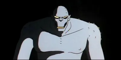 Waylon Jones est atteint d'une maladie rare de la peau qui lui donne l'apparence d'un crocodile.