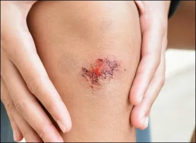 Bon ça va, c'est pas trop méchant !