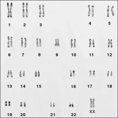 Regardons l'image ci-dessus. Peut-on déterminer le sexe d'une personne grâce à cela ? Si oui, choisis la bonne réponse, dans le cas contraire, tu sais sur quoi cliquer !