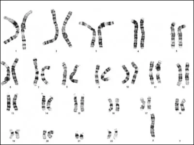 Trouve l'anomalie présente ici.