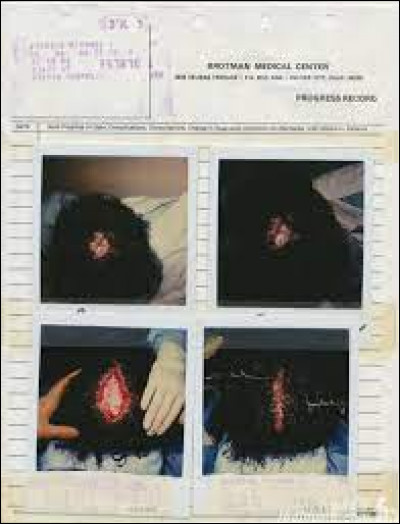 Que fut le diagnostic une fois arriv&eacute; &agrave; l'h&ocirc;pital ?