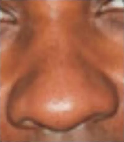 A qui appartient ce nez ?