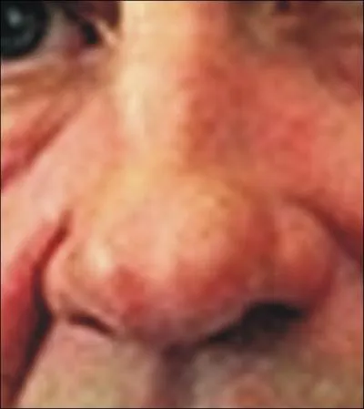 A qui appartient ce nez ?