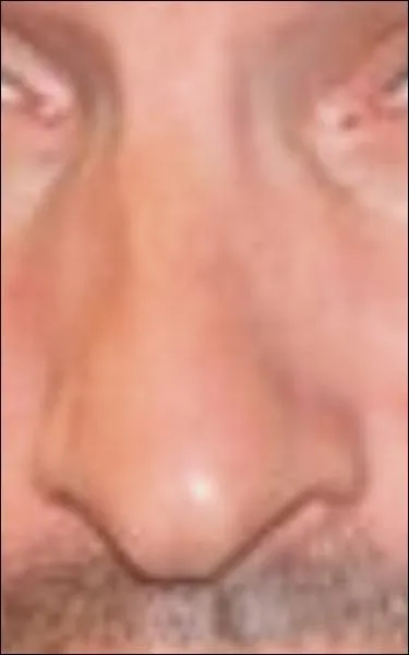 A qui appartient ce nez ?