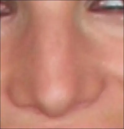 A qui appartient ce nez ?