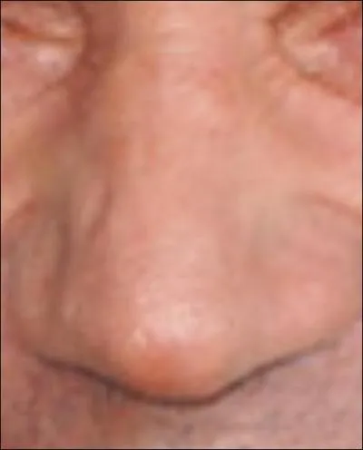 A qui appartient ce nez ?