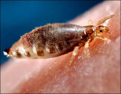 La bêbête en photo est un pou. Il en existe trois sortes, parasites de l'être humain : le pou de tête, le pou de corps et le pou du pubis. Comment appelle-t-on communément le dernier cité ?