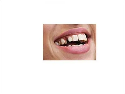 Oups, qui a oubli d'aller chez le dentiste ?