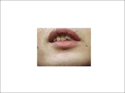 Son ex voulait lui offrir de nouvelle dents, c'est... . ?