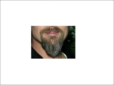 Derrire ces poils se cache... . ?