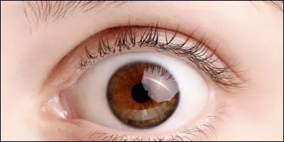 Peut-il y avoir des yeux de cette couleur ?