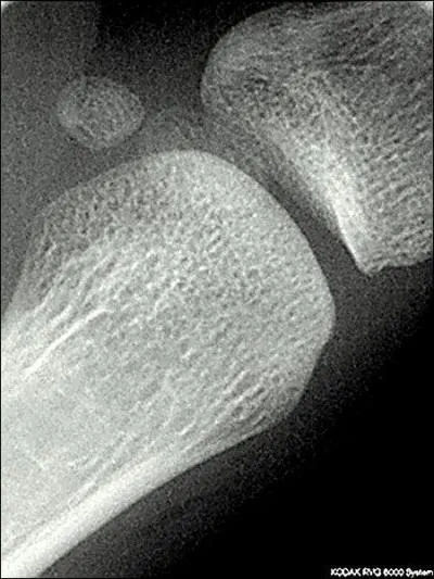 Notre squelette est compos de 204 os  l'ge adulte. Des os ne sont pas comptabiliss, les  ssamodes , ainsi appels car ils :