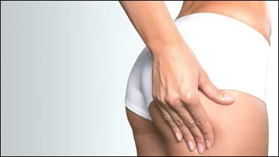 Comment appelle-t-on un amas de graisse à l'arrière des cuisses et des fesses ?