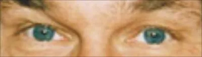A qui appartiennent ces yeux ?