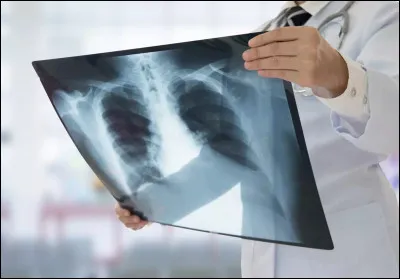 Il y a quelques mois, je me suis fait mal dans mon travail. J'ai dû faire une radio avec comme spécialiste un...