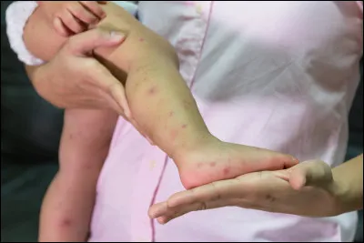 Quels signes peuvent montrer que votre enfant est victime d'abus physiques ?