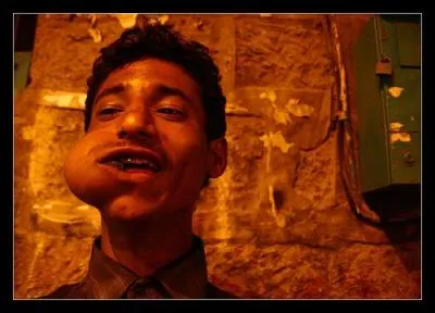 Quelle plante mche cet thiopien