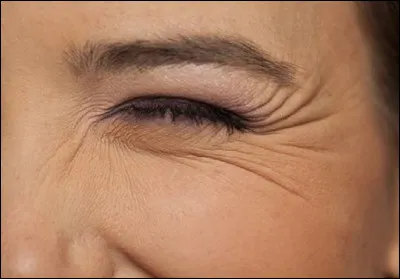 Quel est le nom des rides divergentes que les personnes qui commencent à vieillir ont à langle extérieur de chaque il ?