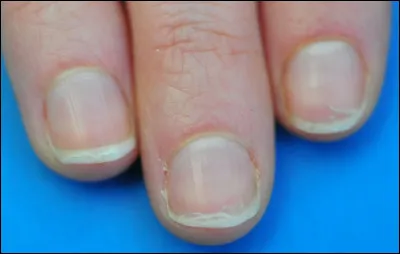 Commune du département des Alpes-de-Haute-Provence, située près de Forcalquier :