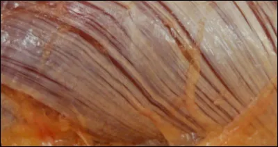 Qu'est-ce que le "fascia" ?