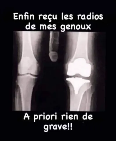 Quel os peut-on trouver dans le genou ?