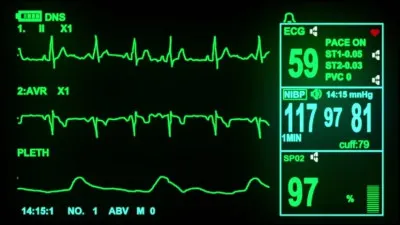 À quelle fréquence ris-tu ?