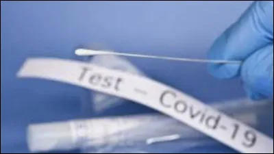 Pour toi, le test PCR te fait mal à combien sur une échelle de un à dix ?