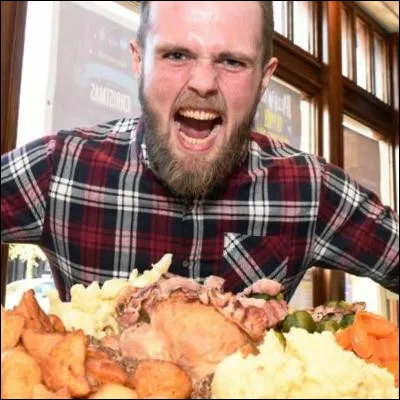 Quel organe, indispensable pour la digestion, surtout en cas de repas lourd ou gras, peut &ecirc;tre touch&eacute; par une chol&eacute;lithiase ?