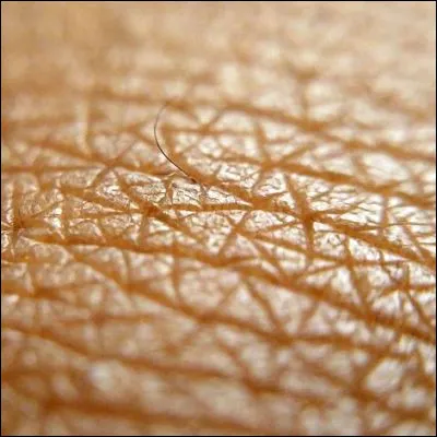 Quelle expression désigne une sensibilité exacerbée ?