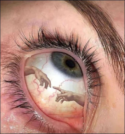 Lequel de ces youtubeurs dévoilait ces derniers mois une vidéo de son opération au laser des yeux pour corriger un défaut de vision ?