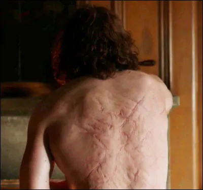 Claire découvre le dos de Jamie : que lui est-il arrivé ?