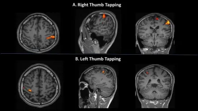 En recherche, l'IRM est un outil fantastique ! Par exemple, l'IRM fonctionnelle permet de visualiser de manière indirecte l'activité cérébrale : on peut déterminer exactement quelles zones du cerveau sont activées quand on parle, réfléchit ou même quand on ment ! Ainsi, on a pu ''cartographier'' notre cerveau. Quel lobe est plus particulièrement impliqué dans la vision ?