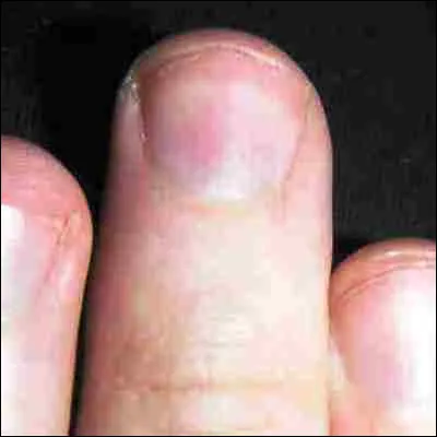 Quelle prot&eacute;ine est la principale composante des phan&egrave;res ?