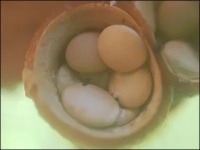 Quel est le nom des petites lentilles que nous voyons dans ce basidiome ?