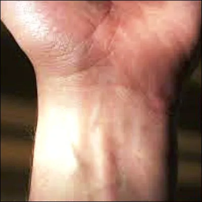 Comment appelle-t-on l�ensemble des os du poignet ?