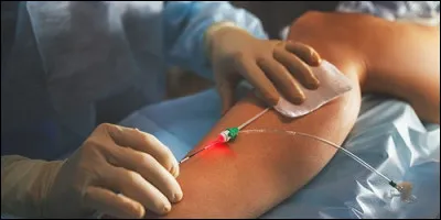 En médecine, comment appelle-t-on le spécialiste des vaisseaux sanguins ?