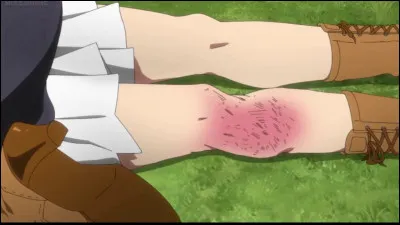 Comment Emma se retrouve-t-elle avec un plâtre ?