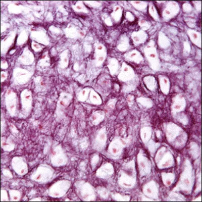 Quel nom donne-t-on à la proéminence formée par le cartilage laryngé ?