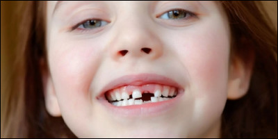 Combien de dents de lait un enfant possède-t-il ?